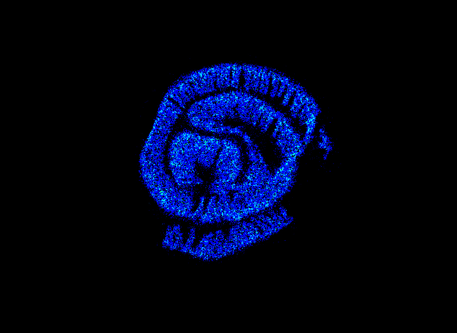AUTORADIOGRAPHY INTcoen