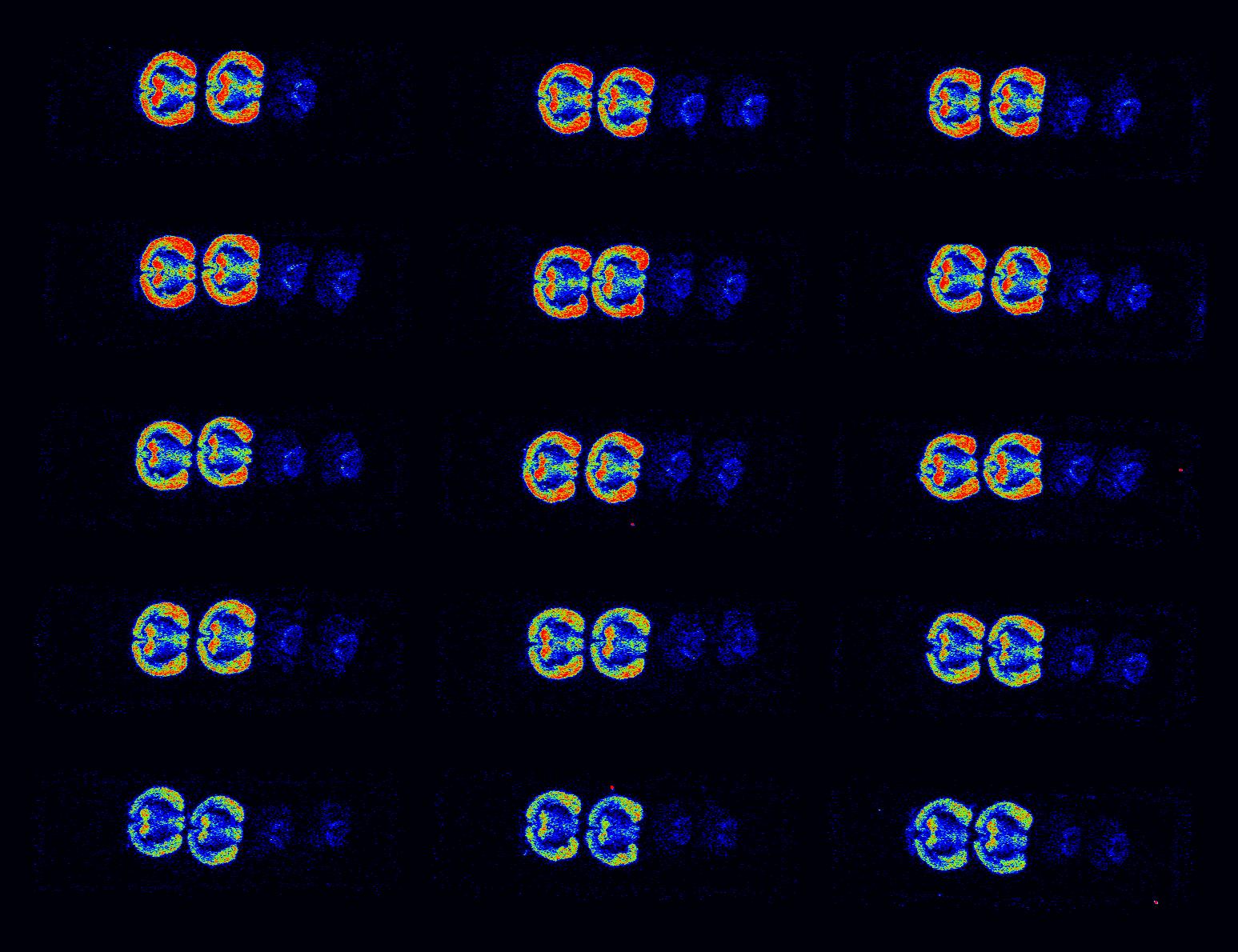 AUTORADIOGRAPHY coronal color